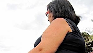 obese woman sitting on bench