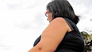 obese woman