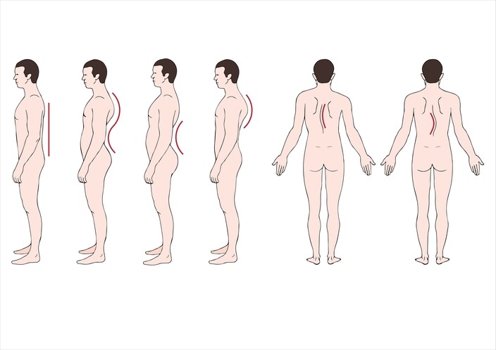 sketches of human deformities