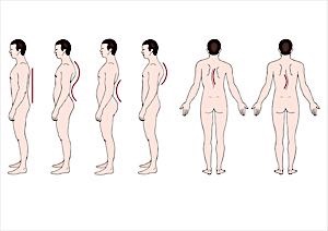 sketches of human deformities